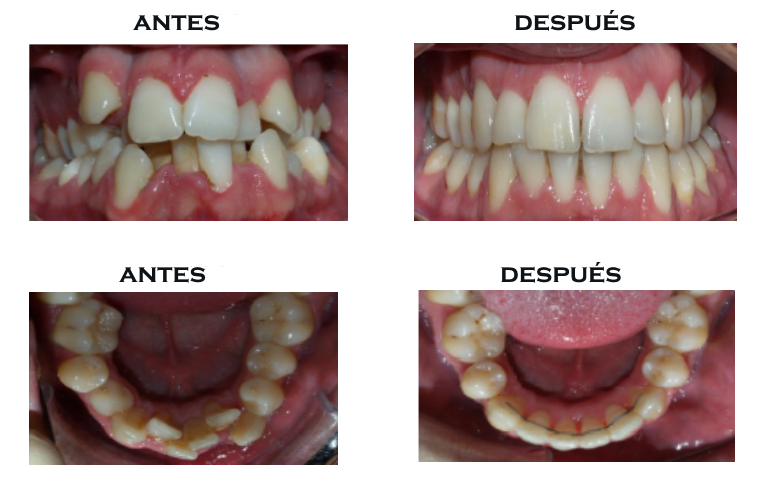 Nuestros casos