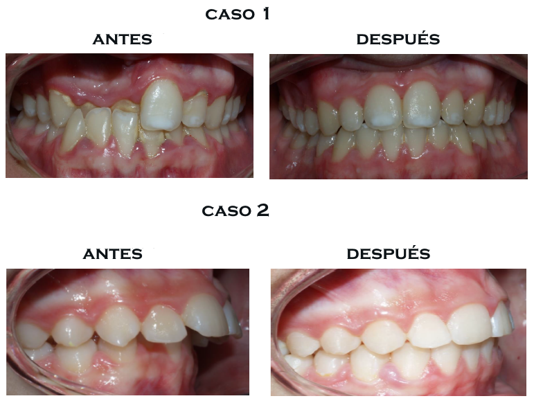 Nuestros casos